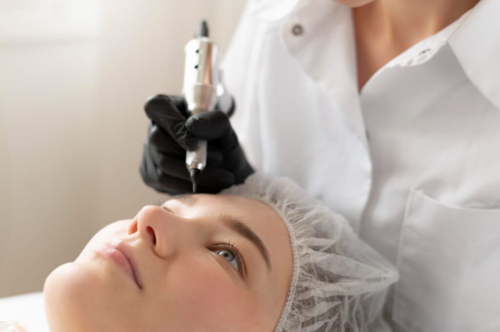 dermapen para cicatrices de acné y textura de la piel Cádiz