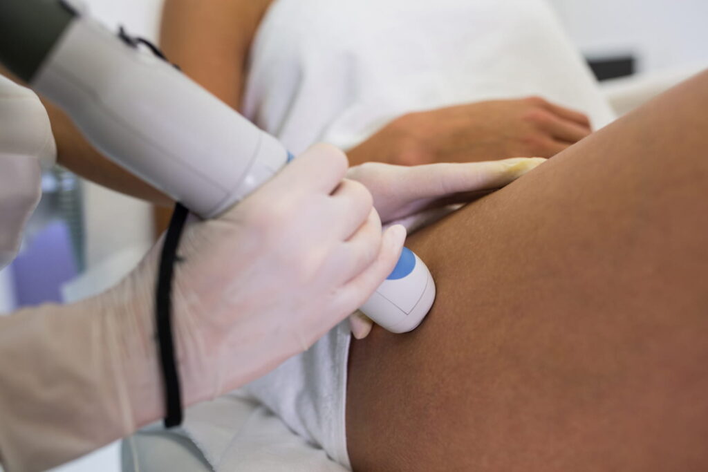 estimulación de colágeno corporal medicina estética Cádiz