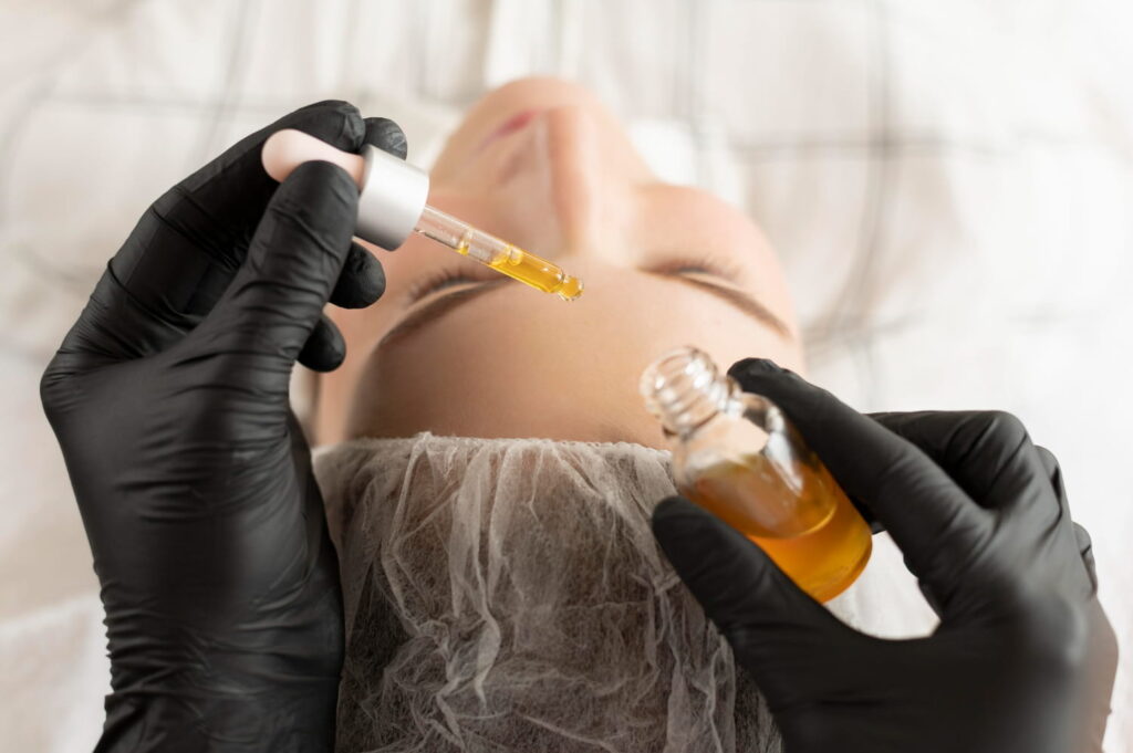 infiltración ácido hialurónico en Chiclana medicina estética